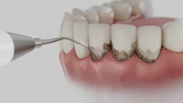 Reliable Dental Implants contractor in Defiance, OH by Smile Center Dentistry